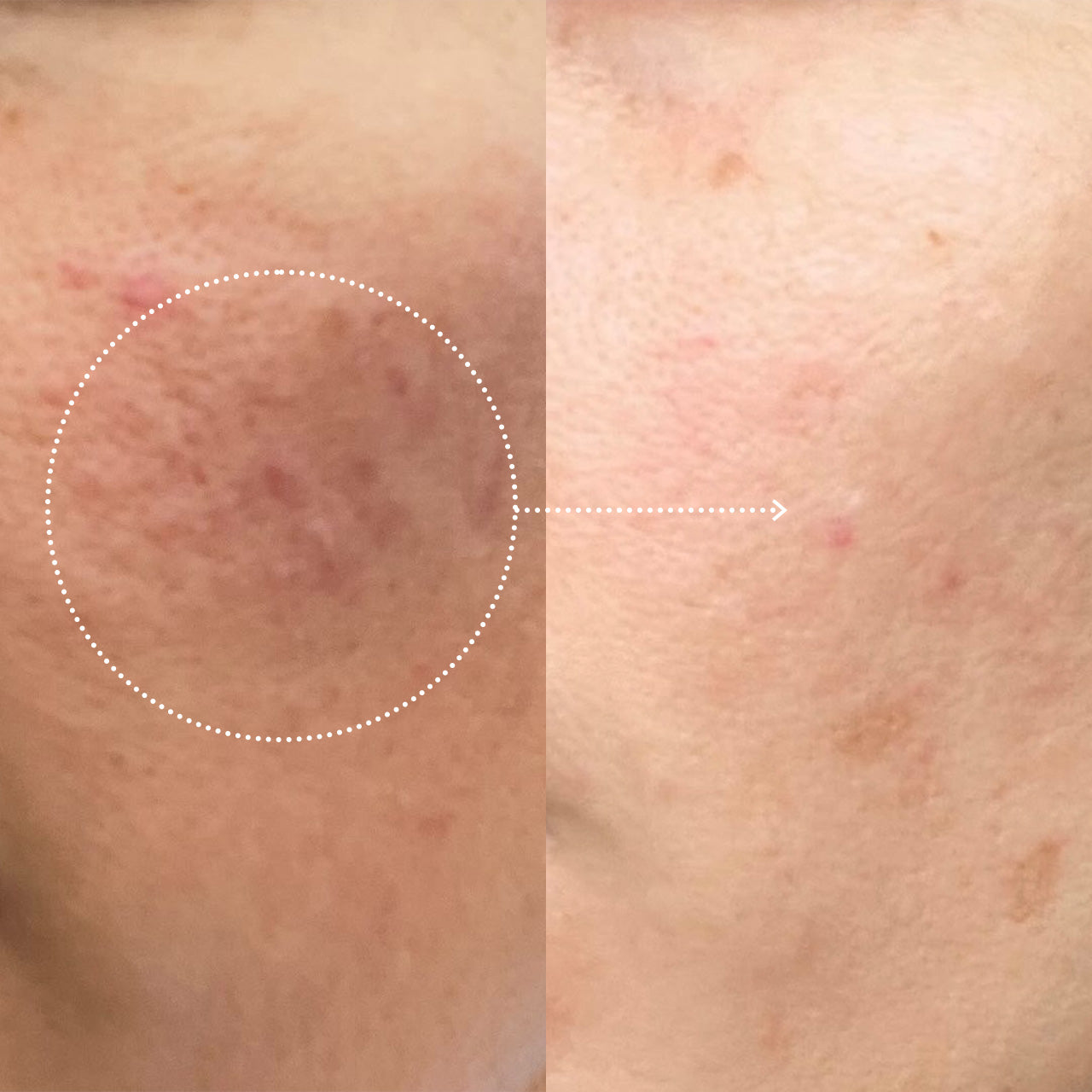 Ultra moisturizing smoothing cream