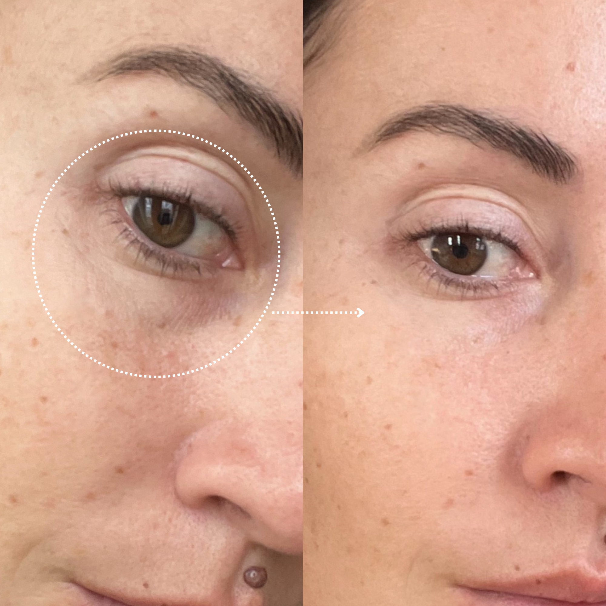 Multipurpose power eye cream