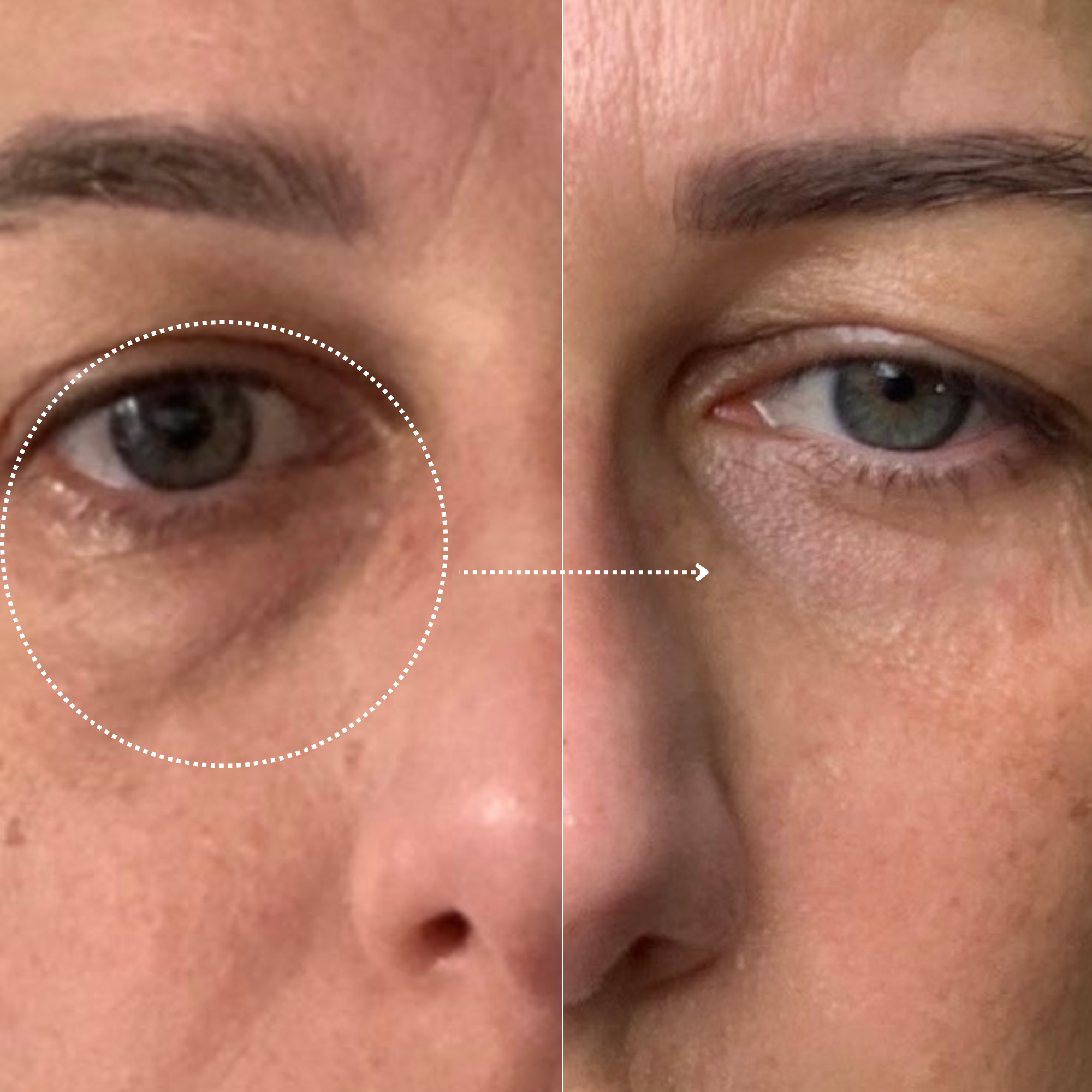 Multipurpose power eye cream
