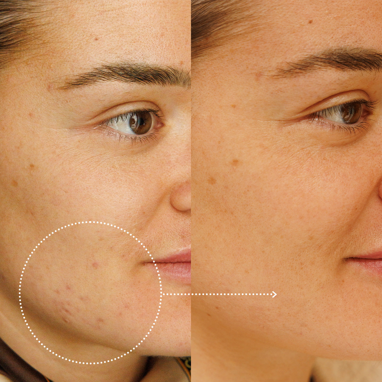 Ideal balance serum