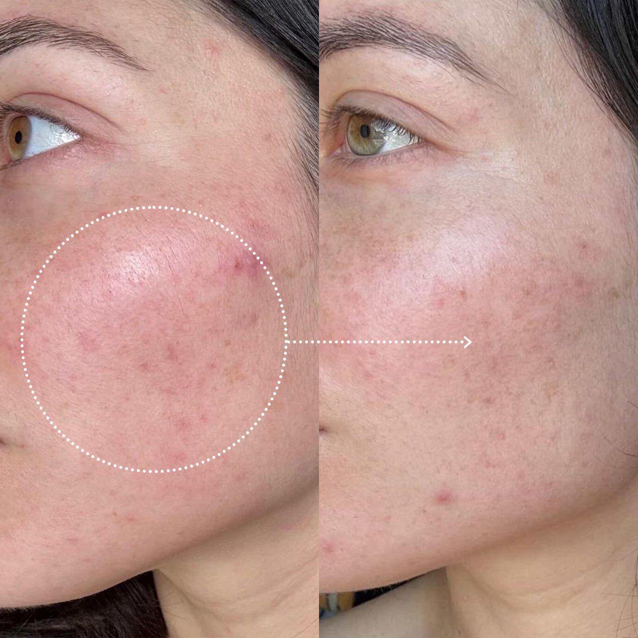 Ideal balance serum