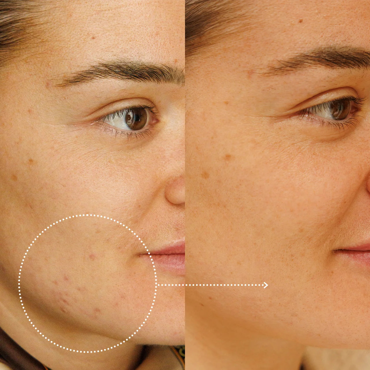 Application du sérum visage équilibre sur le visage