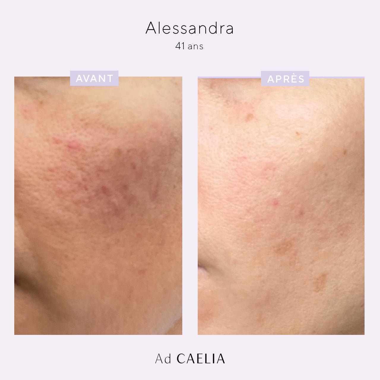 Alessandra_creme_lissante_avant_apres