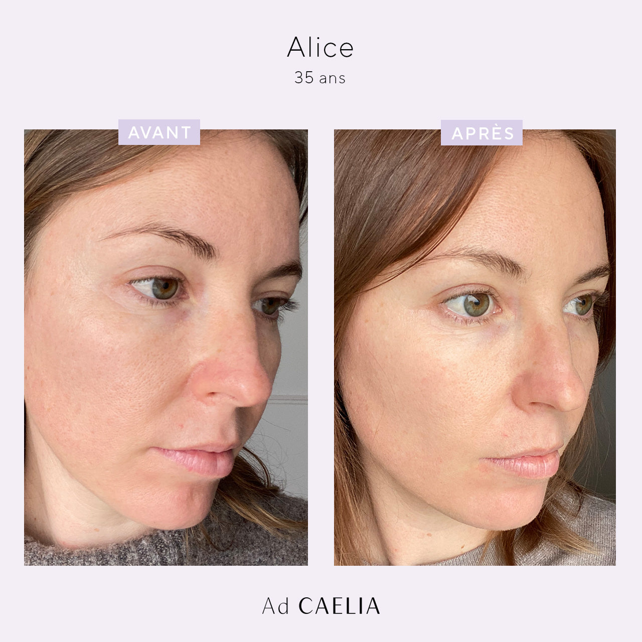 Alice_creme_lissante_avant_apres