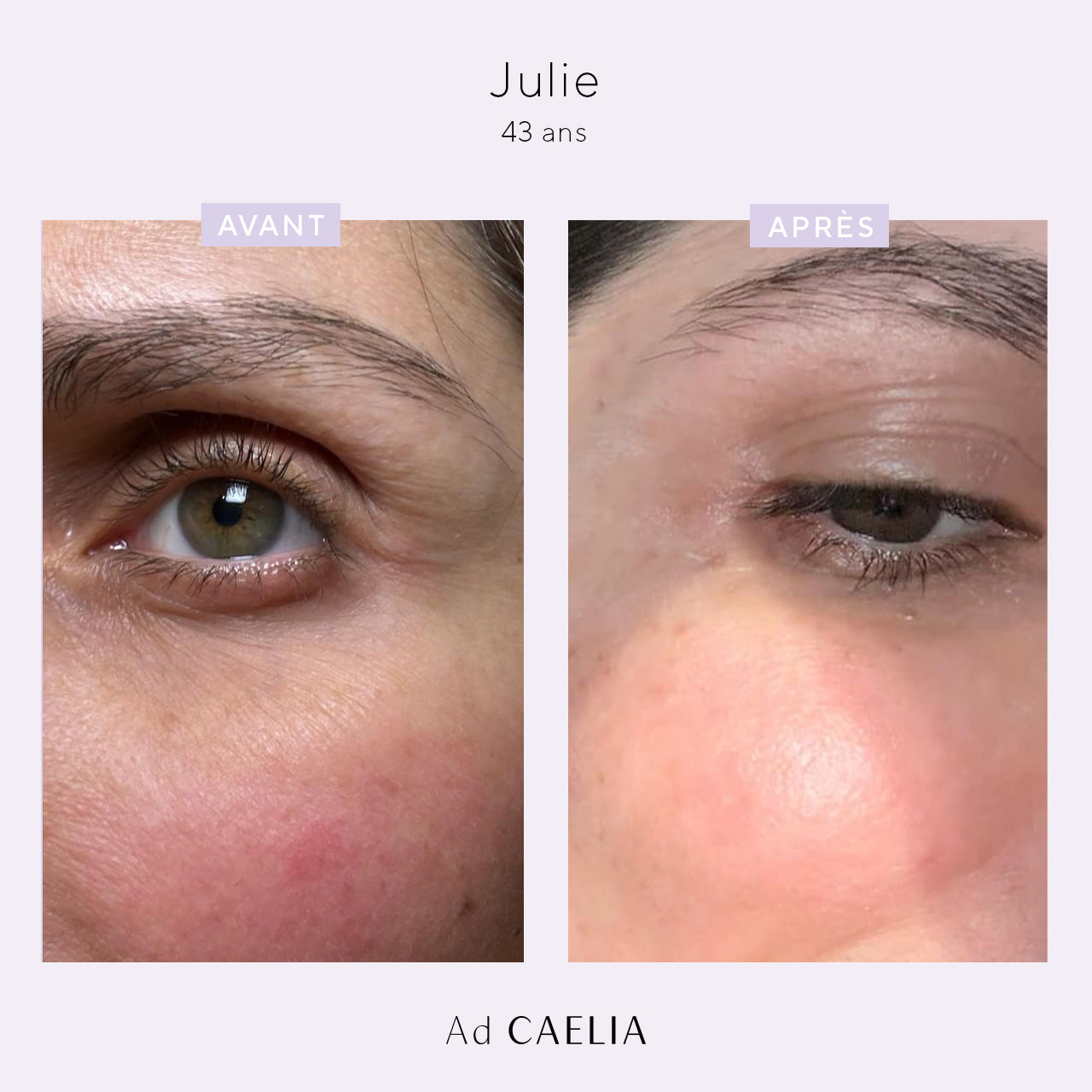 Test_Avant_Apres_Julie_Soin_Contour_des_yeux