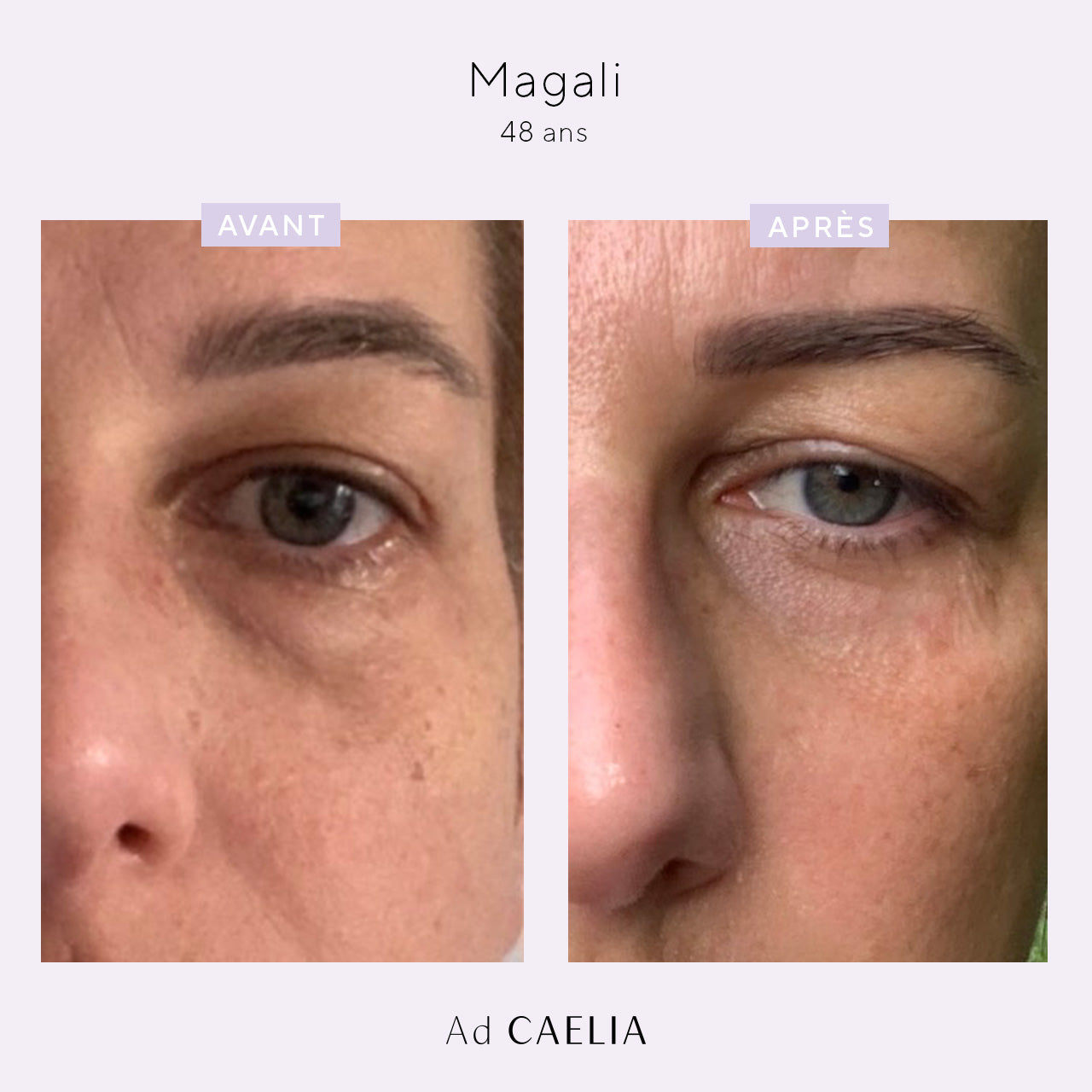 Test_Avant_Apres_Soin_Contour_des_yeux_Magalie