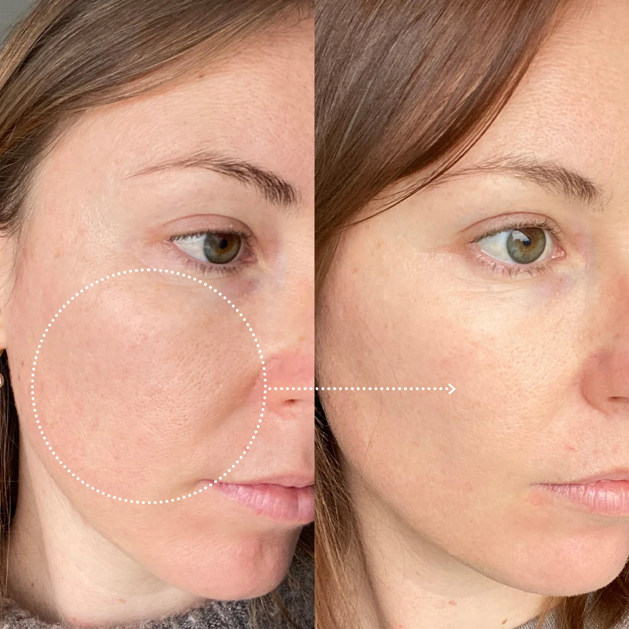 Photo avant après efficacité de la crème visage lissante ultra hydratante Ad CAELIA, bénéfices visibles